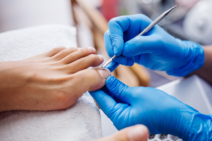 Atendimento podológico para o cuidado das unhas